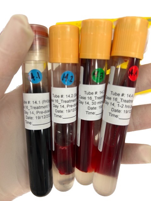 Figure 7: Blood samples collected from each patient during phage therapy. This is what one day of collection would produce.